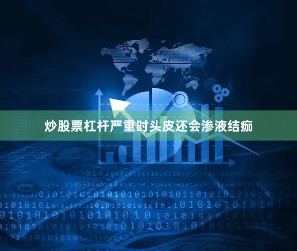 炒股票杠杆严重时头皮还会渗液结痂